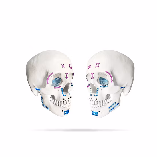 Trauma Titanium Implant Double Y Maxillofacial Plate 1.5mm Screw 0.6mm Thickness Skull Fracture Mini Bone Screw